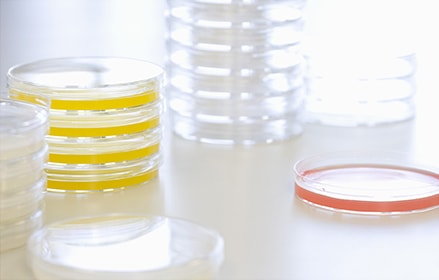 Red and yellow petri dishes